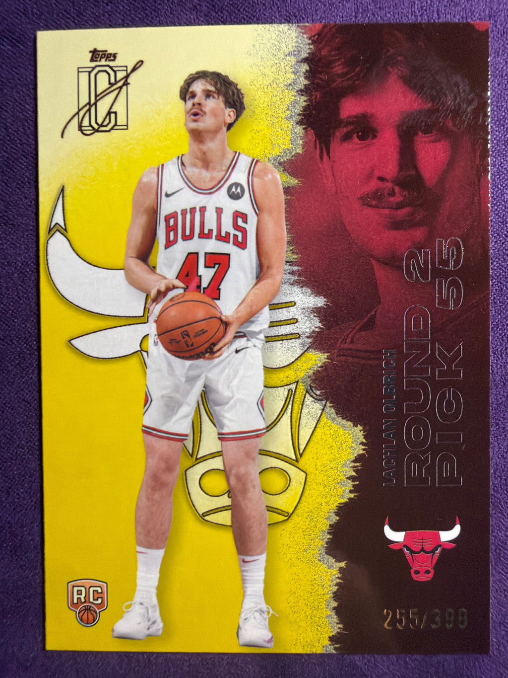 2025-26 Topps Signature Class Lachlan Olbrich RC Yellow #/399 #145 Bulls